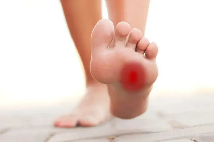 Morton’s Neuroma: everything you didn’t know! DrLuigi