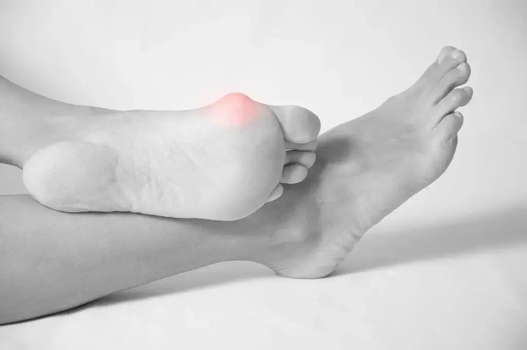 Raynaud's Disease: Understanding the Condition DrLuigi