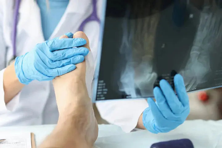 How Does Rheumatoid Arthritis Affect Leg Health? DrLuigi