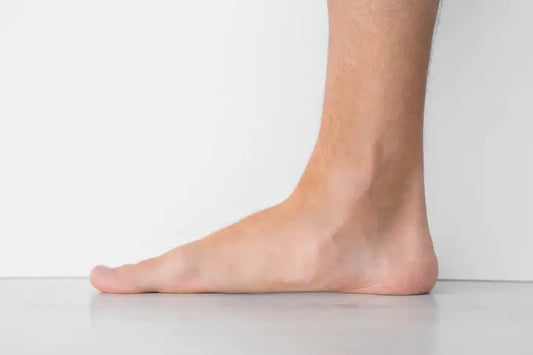 Do You Have Any Of These Symptoms? It Is About Flat Feet… DrLuigi