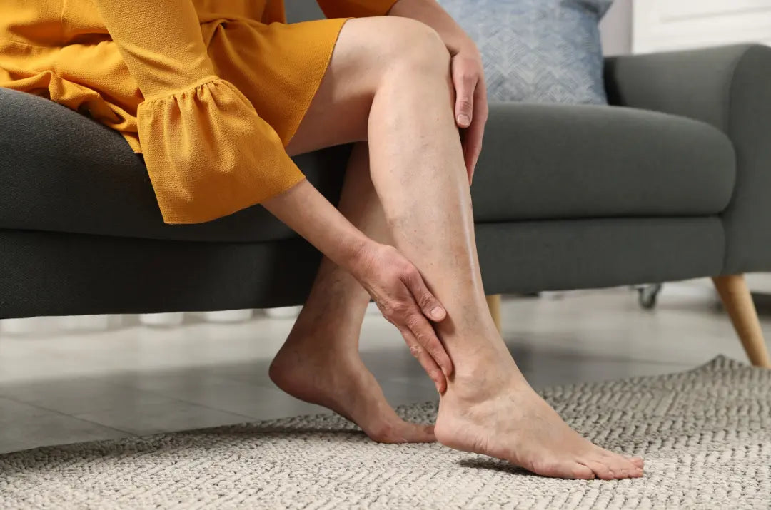 Beyond Pain: Unraveling the Hidden Dangers of Venous Leg Ulcers DrLuigi