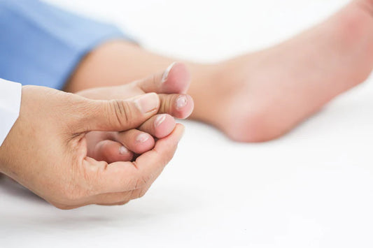 Ingrown Toenails Causes, Prevention & Treatment