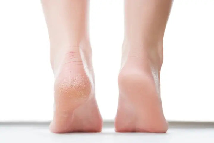 Is an ankle crack harmful? DrLuigi