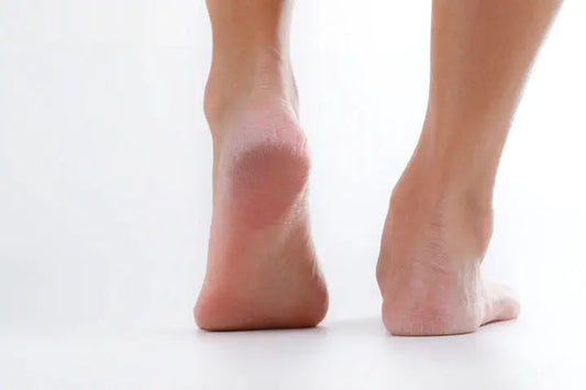 Do You Have Keratolysis With Pits? DrLuigi