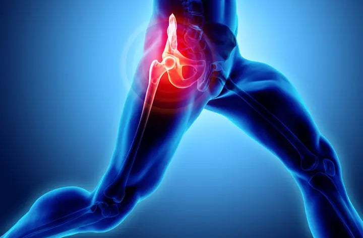 Your Guide to Total Hip Replacement Surgery DrLuigi