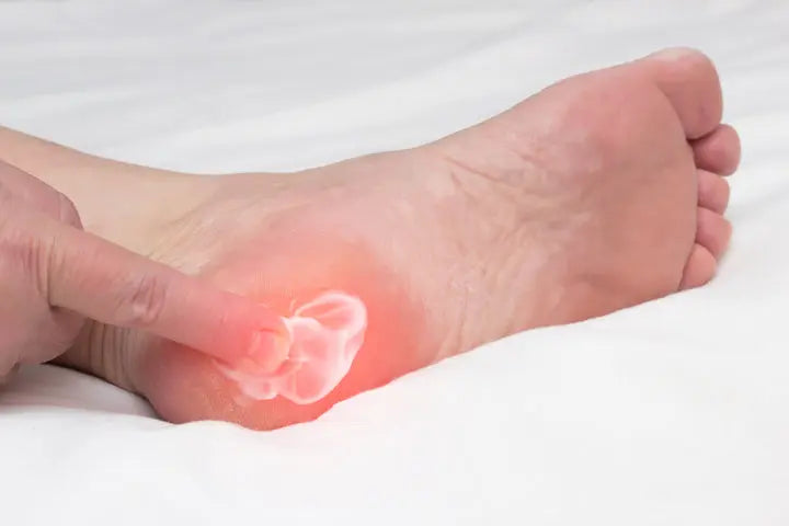 Heel spurs: What you need to know DrLuigi