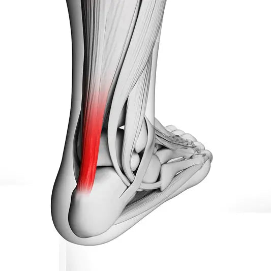 Achilles Tendinopathy DrLuigi