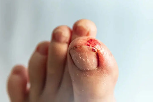 Relief for a Stubbed Toe DrLuigi