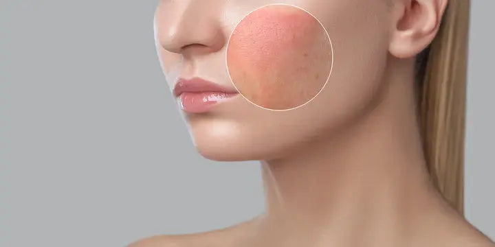 Soft Tissue Biopsy DrLuigi