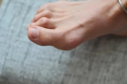 What is Hammertoe? DrLuigi