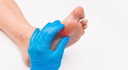 “Cutting” into Foot Health: Understanding the Risks and Prevention of Cuts and Wounds on the Feet DrLuigi