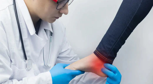 Understanding Calcaneal Spur Pain: Causes and Treatment Options