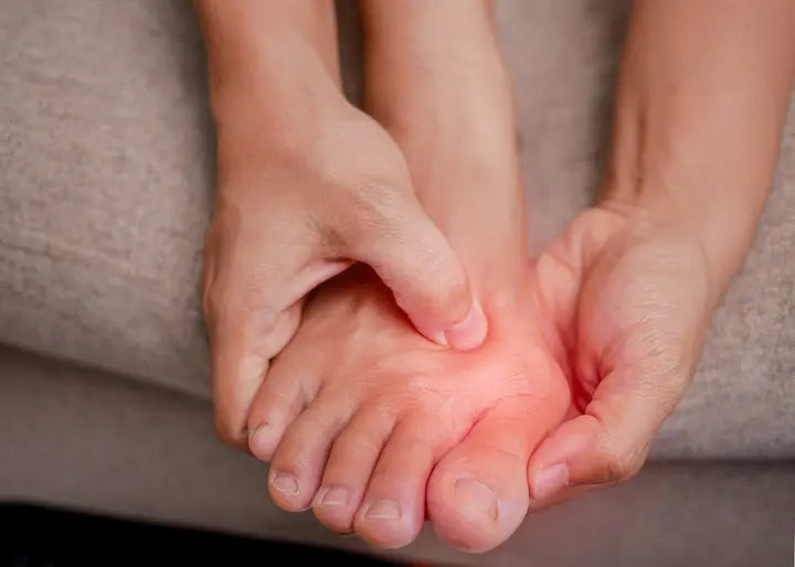 What Exactly Are Bunions? DrLuigi