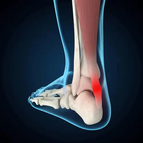 Common Foot Injuries in Sports DrLuigi