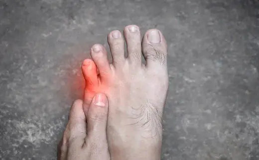 Unveiling the Perils of Ingrown Toenails DrLuigi