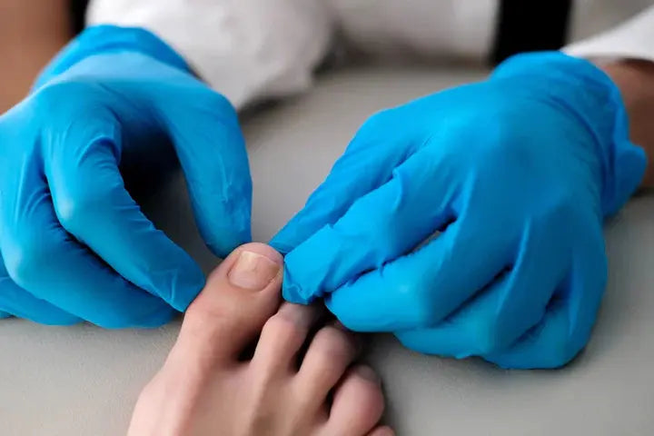 Fungal infections DrLuigi