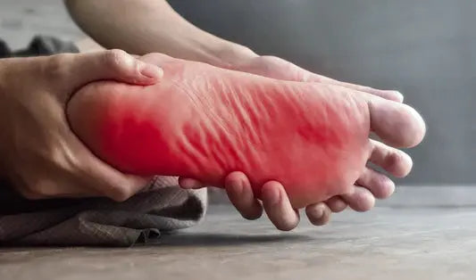 10 Causes of burning in the feet DrLuigi