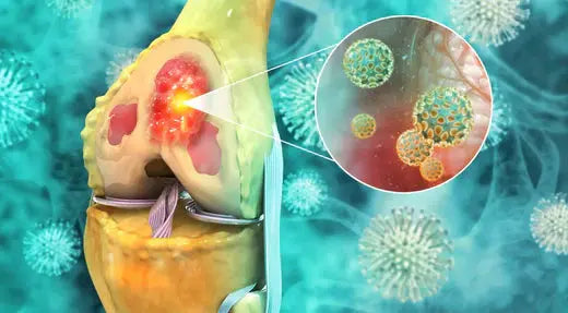 Understanding Bone Cancer DrLuigi