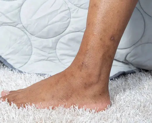 Signs of Aging Legs: Understanding the Visible Changes and Potential Health Risks DrLuigi