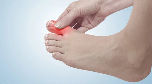 Understanding Red Skin Around the Toenail: Causes and Treatment Options