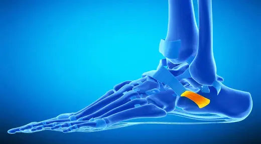 Peroneal Tendonitis: Understanding the Condition and Its Treatment DrLuigi