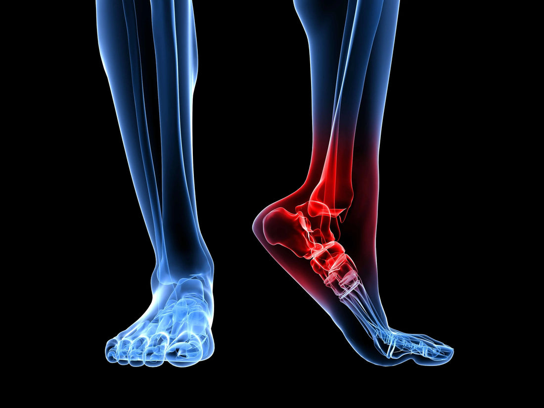 Best Slippers for Plantar Fasciitis: What to Look For to Reduce Heel Pain DrLuigi