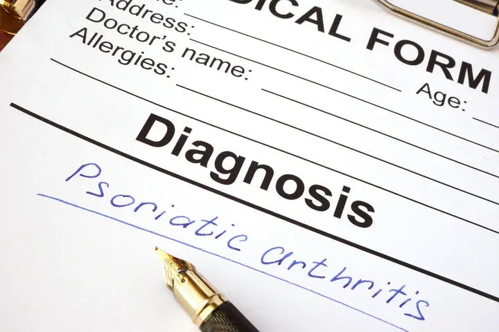 How Does Psoriatic Arthritis Affect Your Body DrLuigi
