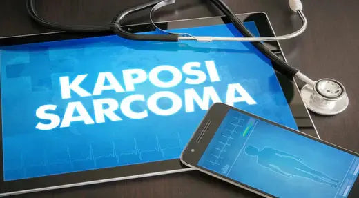 Understanding Kaposi Sarcoma: A Focus on Foot Lesions DrLuigi