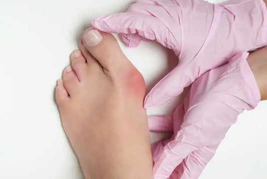 Do you have a bunion? Learn the signs, causes and what to do next DrLuigi
