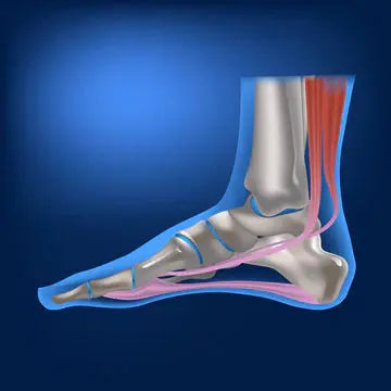 Tarsal Coalition DrLuigi